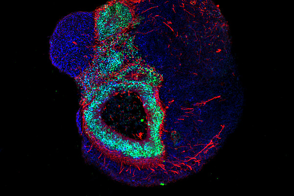 Let’s get cellular – an image from the Max Delbrück Center for Molecular Medicine Cell-based treatment marks a major milestone in patient-centricity.