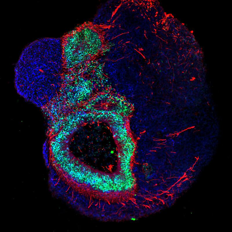 Let’s get cellular – an image from the Max Delbrück Center for Molecular Medicine Cell-based treatment marks a major milestone in patient-centricity.